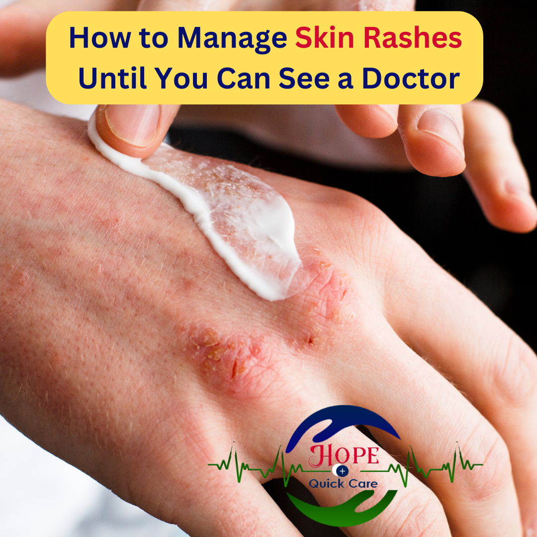 How to Manage Skin Rashes Until You Can See a Doctor